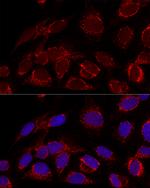 HADHA Antibody in Immunocytochemistry (ICC/IF)