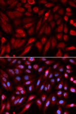 Syntenin 1 Antibody in Immunocytochemistry (ICC/IF)