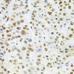 BAF57 Antibody in Immunohistochemistry (Paraffin) (IHC (P))