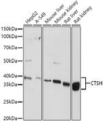 Cathepsin H Antibody in Western Blot (WB)