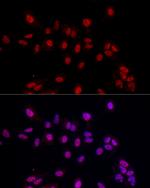 EED Antibody in Immunocytochemistry (ICC/IF)