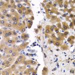 SCP2 Antibody in Immunohistochemistry (Paraffin) (IHC (P))