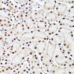 BAF53A Antibody in Immunohistochemistry (Paraffin) (IHC (P))