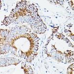 DLD Antibody in Immunohistochemistry (Paraffin) (IHC (P))