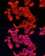 KAO Antibody in Immunocytochemistry (ICC/IF)