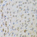 BTD Antibody in Immunohistochemistry (Paraffin) (IHC (P))