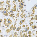 BTD Antibody in Immunohistochemistry (Paraffin) (IHC (P))