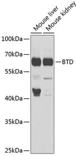 BTD Antibody in Western Blot (WB)