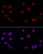 GAS41 Antibody in Immunocytochemistry (ICC/IF)