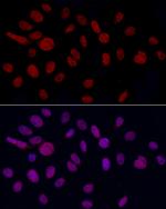 GAS41 Antibody in Immunocytochemistry (ICC/IF)