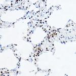 GAS41 Antibody in Immunohistochemistry (Paraffin) (IHC (P))