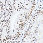 GAS41 Antibody in Immunohistochemistry (Paraffin) (IHC (P))