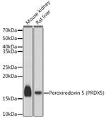 PRDX5 Antibody in Western Blot (WB)