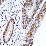 RCC1 Antibody in Immunohistochemistry (Paraffin) (IHC (P))