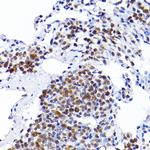 RCC1 Antibody in Immunohistochemistry (Paraffin) (IHC (P))