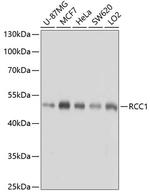 RCC1 Antibody in Western Blot (WB)