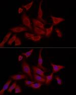 FABP5 Antibody in Immunocytochemistry (ICC/IF)