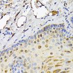 FABP5 Antibody in Immunohistochemistry (Paraffin) (IHC (P))