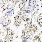 FABP5 Antibody in Immunohistochemistry (Paraffin) (IHC (P))