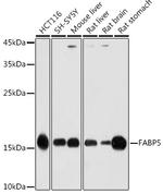 FABP5 Antibody in Western Blot (WB)