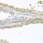 GCDFP-15 Antibody in Immunohistochemistry (Paraffin) (IHC (P))