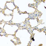 GCDFP-15 Antibody in Immunohistochemistry (Paraffin) (IHC (P))