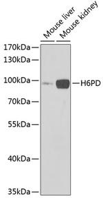 H6PD Antibody in Western Blot (WB)