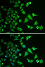 DHRS2 Antibody in Immunocytochemistry (ICC/IF)