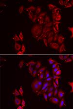 PAICS Antibody in Immunocytochemistry (ICC/IF)