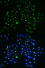 Nucleostemin Antibody in Immunocytochemistry (ICC/IF)