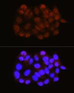 NRBF2 Antibody in Immunocytochemistry (ICC/IF)