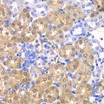 HPD Antibody in Immunohistochemistry (Paraffin) (IHC (P))