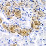 HPD Antibody in Immunohistochemistry (Paraffin) (IHC (P))