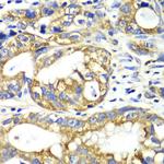 Adenylate Kinase 2 Antibody in Immunohistochemistry (Paraffin) (IHC (P))