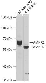 AMHR2 Antibody in Western Blot (WB)