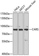 CARS Antibody in Western Blot (WB)