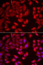 TCP-1 beta Antibody in Immunocytochemistry (ICC/IF)