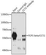 TCP-1 beta Antibody in Immunoprecipitation (IP)