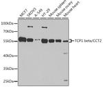 TCP-1 beta Antibody in Western Blot (WB)