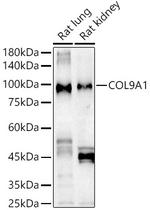 COL9A1 Antibody in Western Blot (WB)