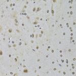 DDX1 Antibody in Immunohistochemistry (Paraffin) (IHC (P))