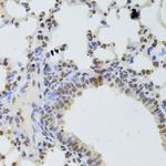 DDX1 Antibody in Immunohistochemistry (Paraffin) (IHC (P))