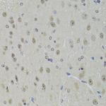 DDX1 Antibody in Immunohistochemistry (Paraffin) (IHC (P))