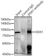 DDX1 Antibody in Immunoprecipitation (IP)