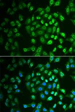 FAH Antibody in Immunocytochemistry (ICC/IF)