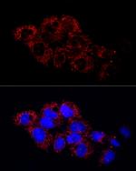 GluD2 Antibody in Immunocytochemistry (ICC/IF)