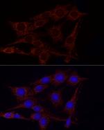 GluD2 Antibody in Immunocytochemistry (ICC/IF)