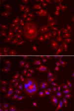 GRASP65 Antibody in Immunocytochemistry (ICC/IF)