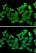 HAGH Antibody in Immunocytochemistry (ICC/IF)