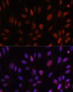 HOXB1 Antibody in Immunocytochemistry (ICC/IF)